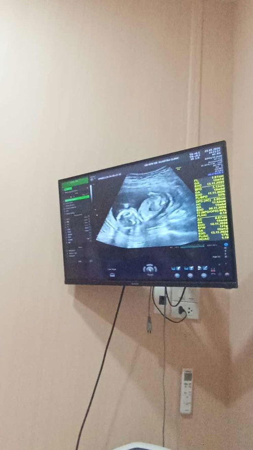 น้ำหนักตัวน้องปกติตามเกณฑ์มั้ยคะ