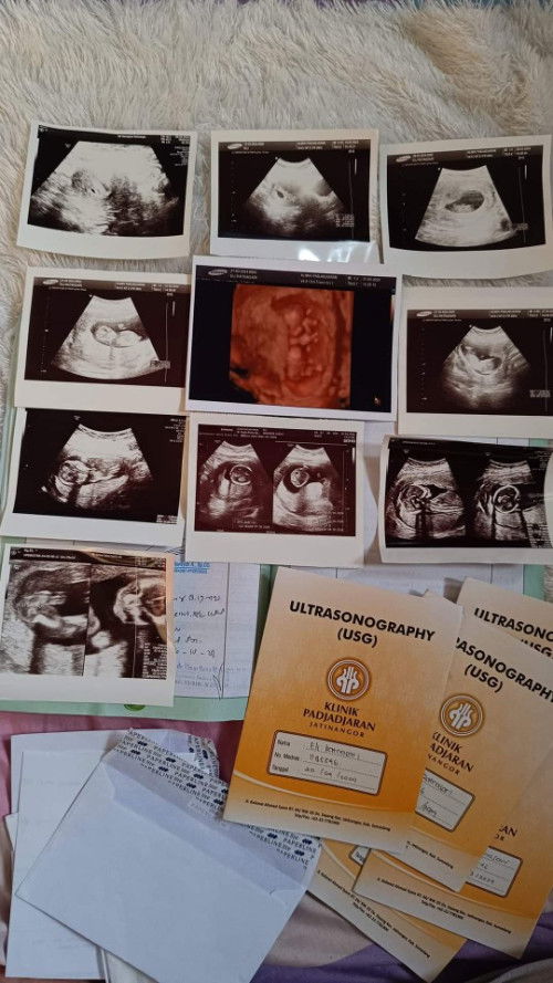 Pamit dari grup,terimakasih TAP 🥰