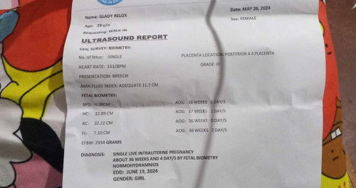 Breech position si baby
#36weeks and 5days