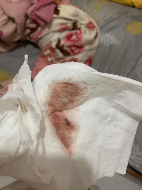 Keluar flek tanpa ada kontraksi