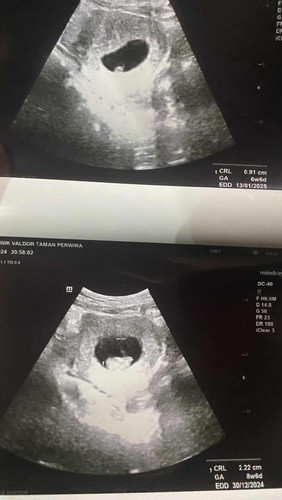 Takut tapi bershukur dapat pregnant