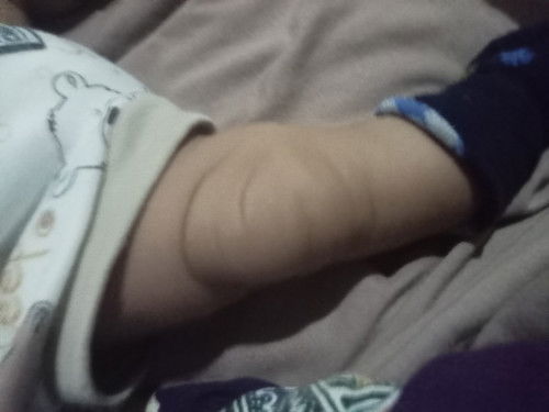 Bb bayi seret setelah ganti sufor