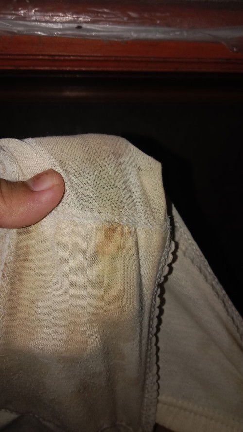 Mau nanya bun ini apa yah tadi keluar begitu