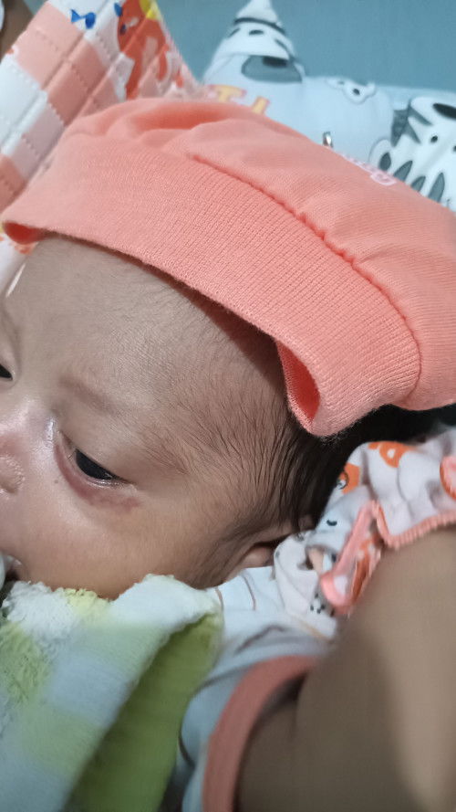 Mata blobok /belekan