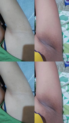 Hormonal Changes