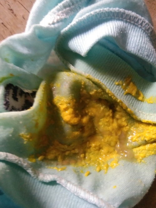 Sedih bgt bayi ku diare trus