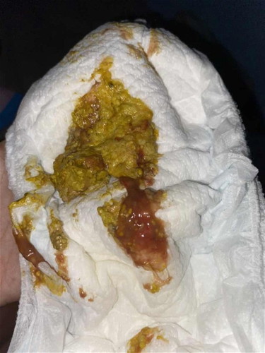 Pup bayi berlendir dan berdarah