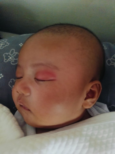 Namagang mata ni baby