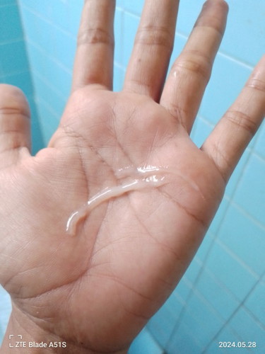37+1วีค แบบนี้มูกใสว่าตกขาวค่ะ