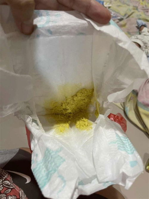 MAAF AGAK JOROK , PUUP BAYI BEGINI TANDANYA SEHAT GAK YA ? Usia bayi 4 Hari
Berhubung Asi seret