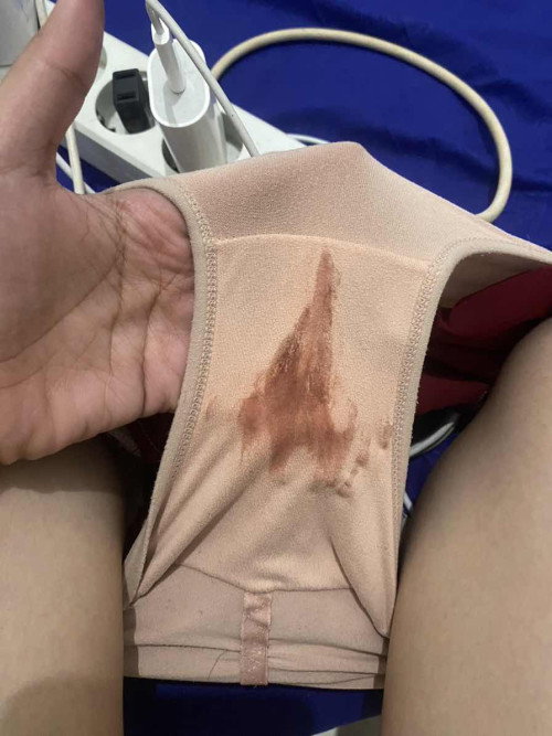 flek selama 3 minggu
