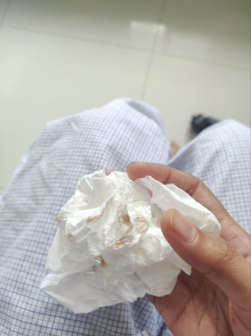 Ngefelk coklat muda di usia kandungan 6-7 week