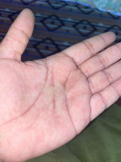 อยากทราบว่าแบบนี้เป็นมูกใสหรือเป็นตกขาวคะ ควรไปหาหมอเลยไหม