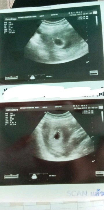 ซาวไม่เจอตัวน้อง