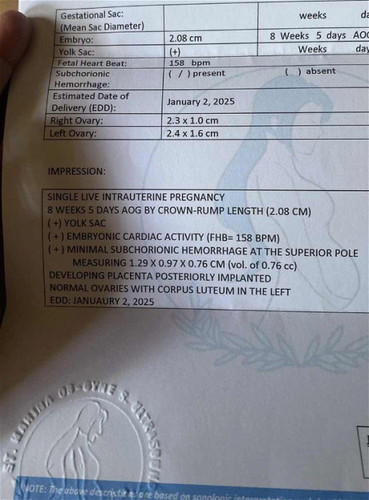 Subchorionic hemorrhage at the superior pole