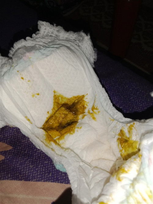 Warna feses bayi