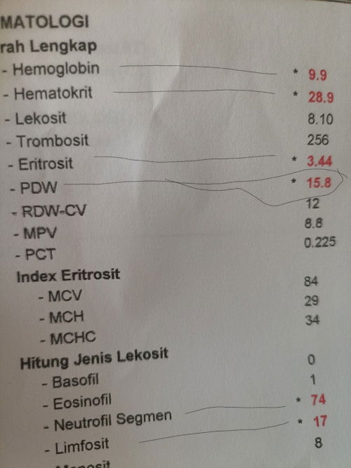 Hasil Laboratorium HB