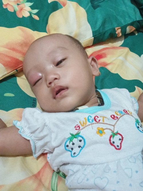 Gatau matanya digigit apa