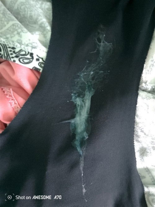 Mucus plug na po kaya ito? I'm 40 weeks pregnant