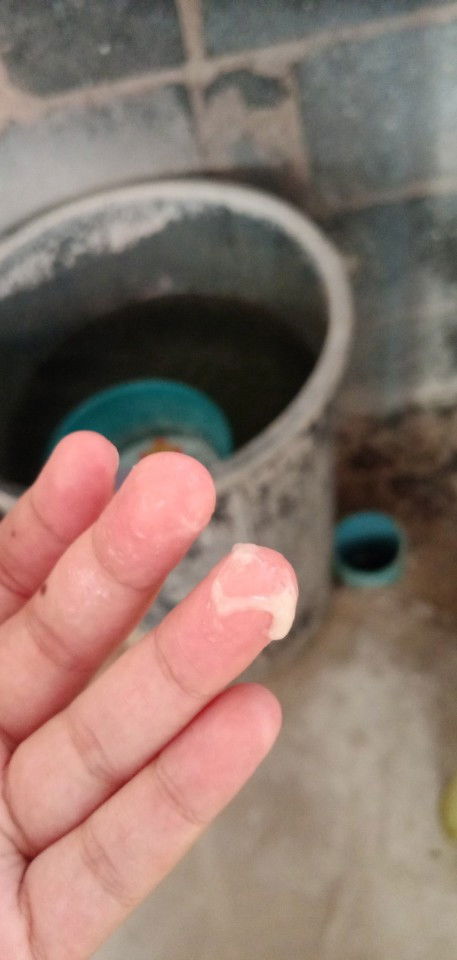 #ท้องแรกค่ะ ตอนนี้ท้อง36+4