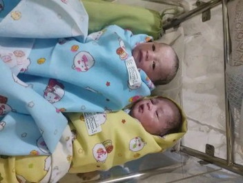 Bayi lahir kembar