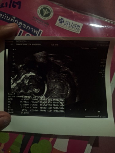 19w ทีมตุลา