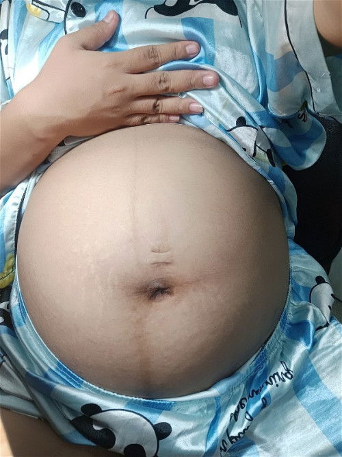 สวัสดีดีค่ะแม่ๆ ทีมมิถุนายน 
มีใครแอบแตกไปบ้างแล้วค่ะ 
#เดาทรงท้อง🥰