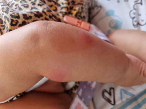 Krim Gatal² apa yg sesuai utk baby??
