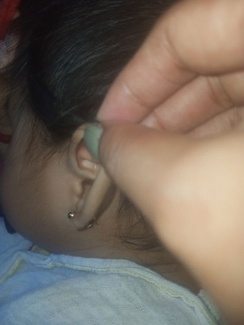 ano po kaya itong nasa bandang tenga ng baby ko mg 3weeks ko n po ito napapancin e