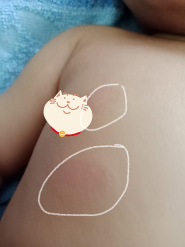 Hi mommies ano po kaya itong nsa skin ni baby?
3months po Siya exclusive breastfeeding.
Thankyou po