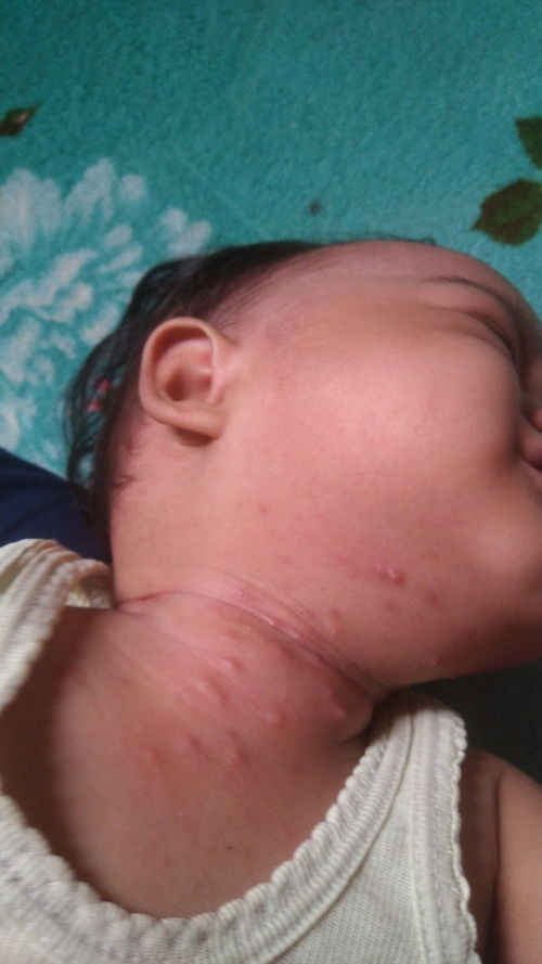 BINTIK BESAR GAK SEMBUH2