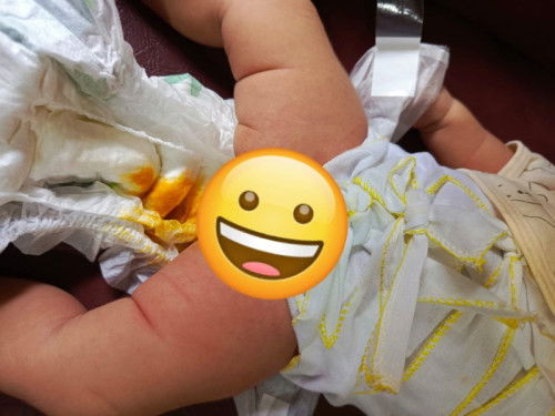 Ini pup normal atau mencret?