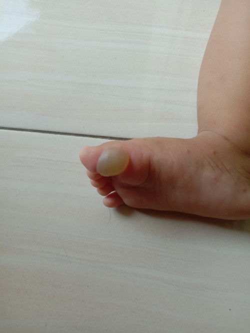 Ini namanya apa yaa buun?