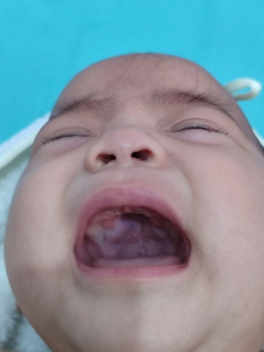 Ngala ngala ni baby