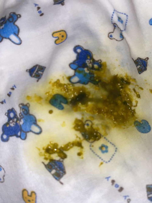 สอบถามค่ะแม่ๆแบบนี้ลูกเป็นอะไรคะ