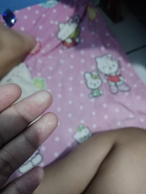 Keluar cairan 36minggu