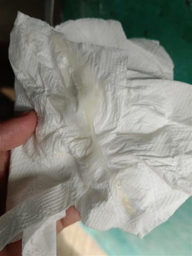 Mucus plug