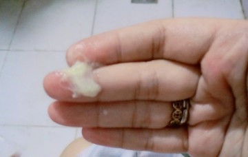 High Risk 28 weeks pregnant