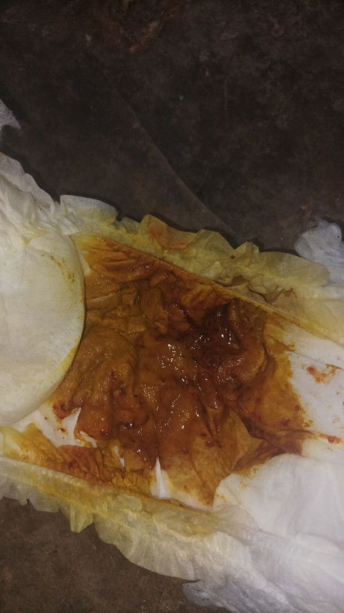 Diare, pada bayi 16bulan