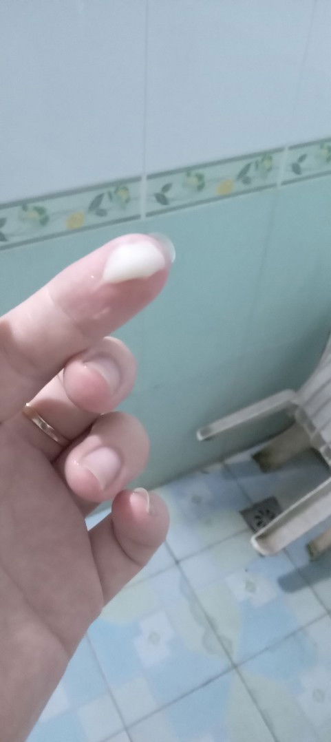 E bầu 29tuần vừa thấy ướt đũng quần thấy cục nhầy trắng ở đũng quần. E mới xn ở viện thì k bị viêm