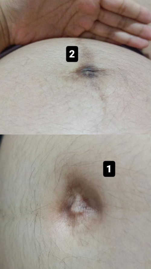 Pusar kenapa makin hitam ya ??😭