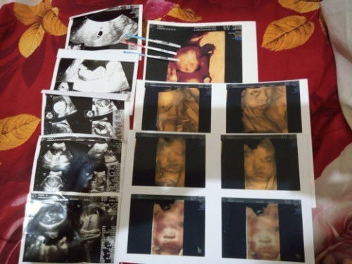 Mengenang masa hamil