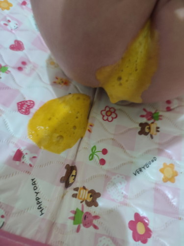 1 and half months po si baby ko bakit po kaya minsan bula yung poops nya