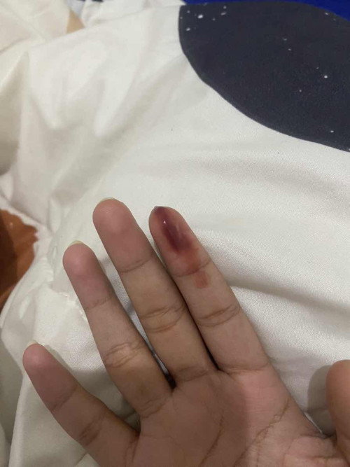 flek  setiap hari tak kunjung berhenti sudah 3 minggu lamanya