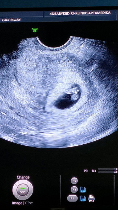 HPHT 16 APRIL ANAK KE 2 HLP JANUARI