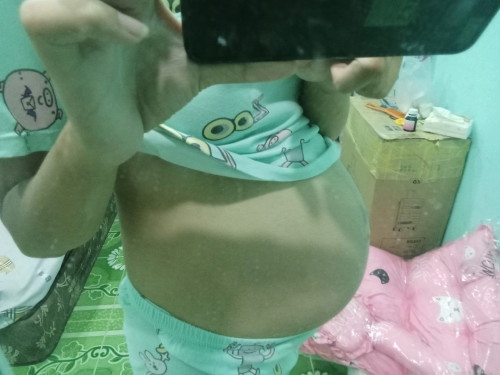 36w ท้องเล็กมั้ยคะ
