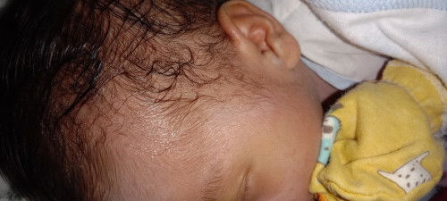 ทำไมเหงื่อชอบออกจังเลยค่ะ