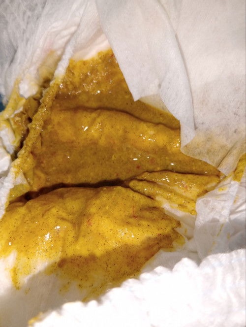 Bercak pada pup baby