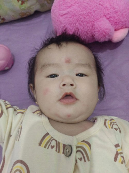 Bintik merah di muka