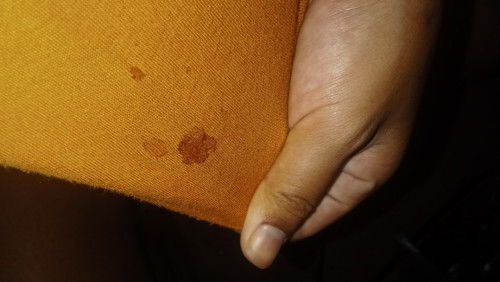 น้ำนมเป็นสีแดง